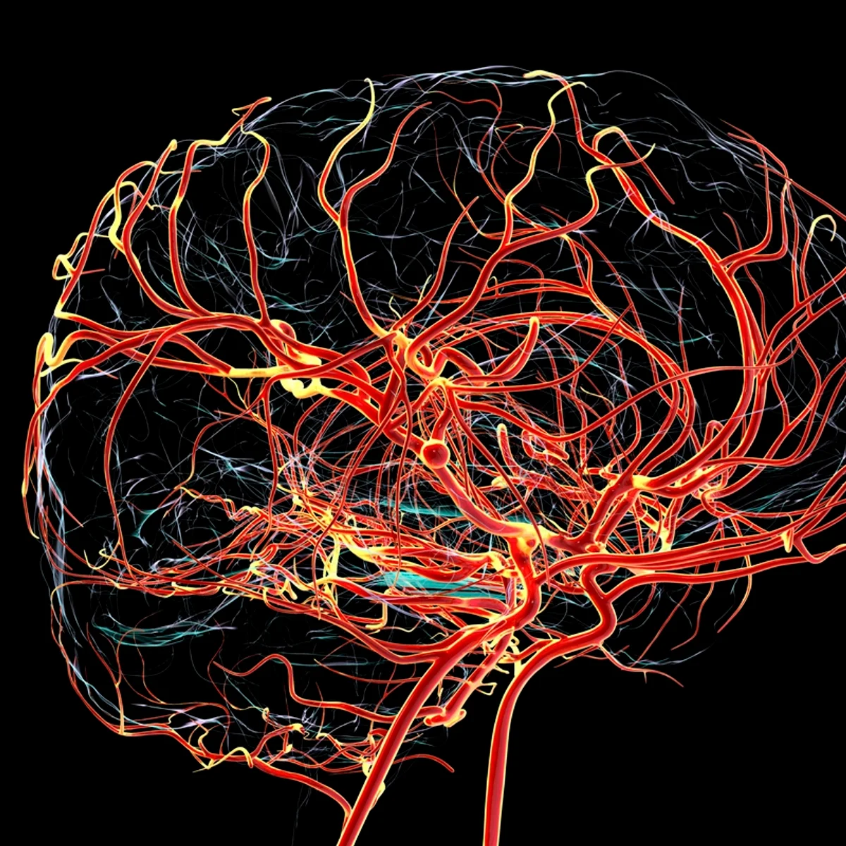 Alterações do Alzheimer podem surgir antes de falhas na memória, diz estudo