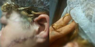 Suspeito teria desfigurado rosto da ex-esposa ao golpe&aacute;-la com uma faca Foto: Reprodu&ccedil;&atilde;o/TV Anhanguera