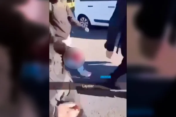 Estudante de 15 anos tem mão arrancada por explosão de granada na França - destaque galeria