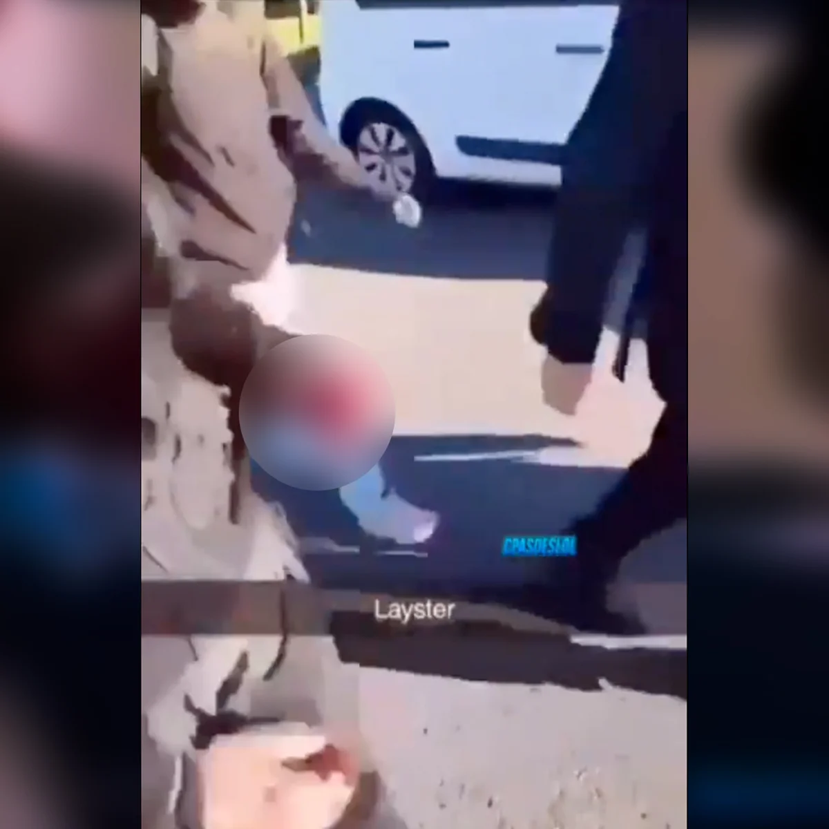 Estudante de 15 anos tem mão arrancada por explosão de granada na França