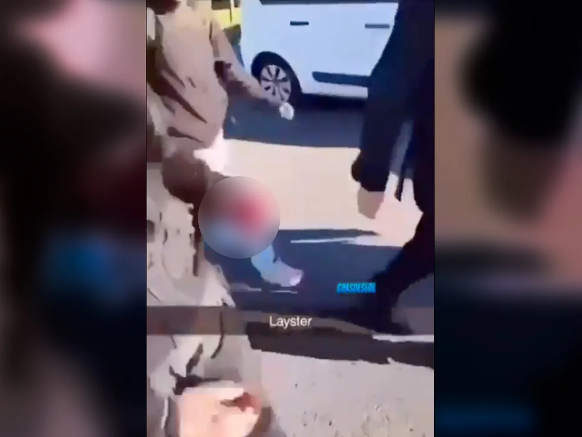 Estudante de 15 anos tem mão arrancada por explosão de granada na França